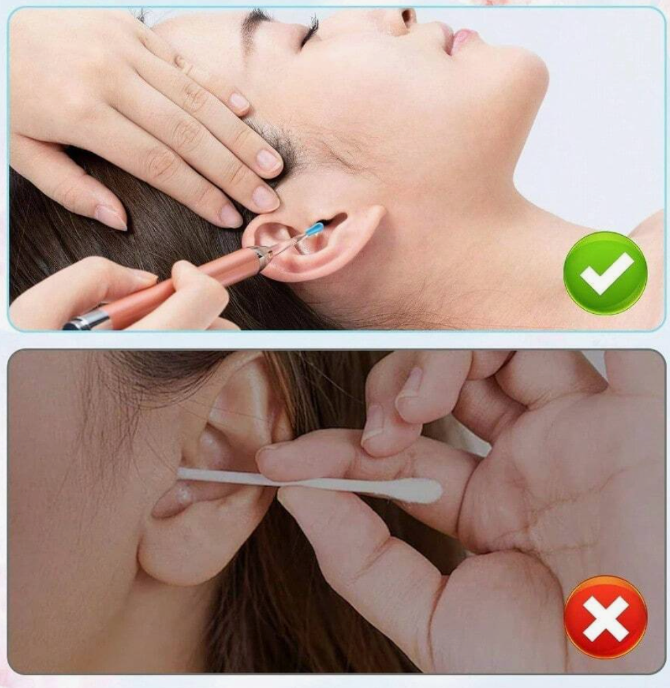 90 PCS Ear Wax Removal Tips/EarVision Tips